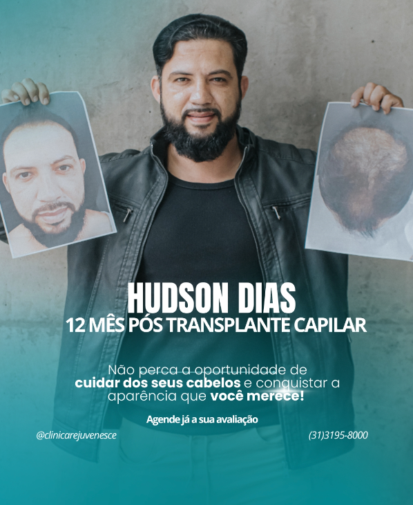 Hudson Dias 