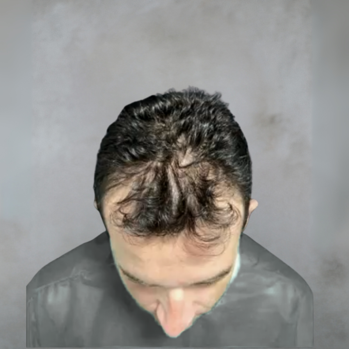 Imagem de baixo esquerda